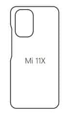 emobilshop Hydrogel - zadná ochranná fólia - Xiaomi Mi 11X