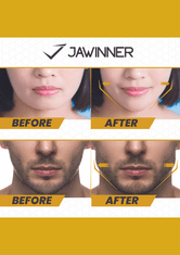JAWINNER WINBUILDERS / POKROČILÝ - Posilňovač čeľustí - Tvárový toner - Jawline trainer