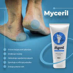 Myceril  - Dokonalé riešenie na plesne na nechtoch a chodidlách - 80 ml osvedčeného prípravku na účinnú liečbu plesňových infekcií