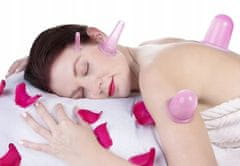 Soulima  Súprava masážnych silikónových baniek proti celulitíde 5 ks ružovej
