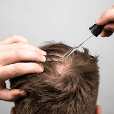 Bio-Pilixin Activation Serum na spomalenie vypadávania a podporu rastu vlasov pre mužov 100 ml