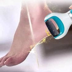 FRILLA® Elektrický vodotesný pilník na nohy s otočnou hlavicou | SMOOTHFEET