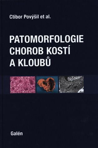 Patomorfológia chorôb kostí a kĺbov