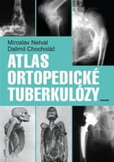 Atlas ortopedickej tuberkulózy