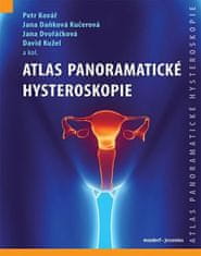 Atlas panoramatické hysteroskopia