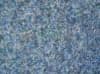 Spoltex AKCIA: 80x400 cm Koberec metráž Rambo 77 modrý (Rozmer metrového tovaru Bez obšitia)