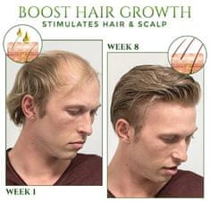 FRILLA® Sprej na regeneráciu vlasov | GETHAIR