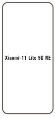 emobilshop Hydrogel - ochranná fólia - Xiaomi 11 lite 5G NE (case friendly)
