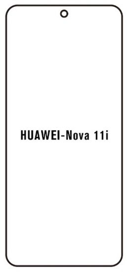 emobilshop Hydrogel - matná ochranná fólia - Huawei Nova 11i