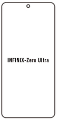 emobilshop Hydrogel - ochranná fólia - Infinix Zero Ultra