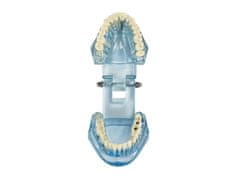 Sobex Zubný model čeľuste zuby zubné implantáty