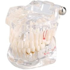 Verk 01964_B Model zubných implantátov biela