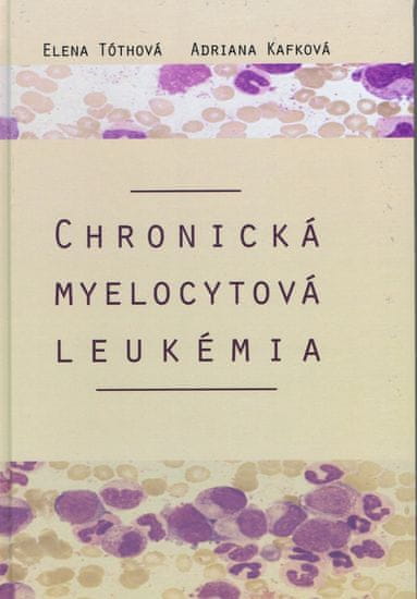Kafková, Elena Tóthová Adriana: Chronická myelocytová leukémia