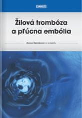 Anna Remková: Žilová trombóza a pľúcna embólia