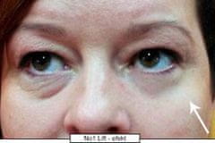 Revolučný očný krém s okamžitým efektom No.1 Lift (Eye Cream) 15 ml