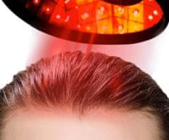 Yalong Trade Kingray Laserová čiapka na podporu rastu vlasov 96 diód, spolu 400mW