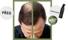 Natucain - Natura l Hair Activator 100 ml