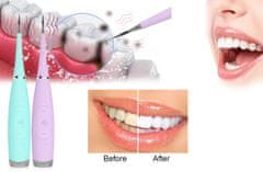 CoolCeny Ultrazvukový čistič zubov - Ružová
