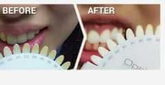 Bieliaca zubná pasta Sensitivity Relief 133g