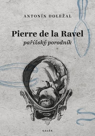Antonín Doležal: Pierre de la Ravel, pařížský porodník