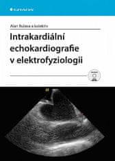 Alan Bulava: Intrakardiální echokardiografie v elektrofyziologii