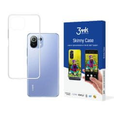 3MK Skinny puzdro pre Xiaomi Mi 11 Lite 5G/Mi 11 Lite 4G/Mi 11 Lite 5G NE - Transparentná KP20186