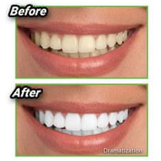 commshop Prírodné uhlie na bielenie zubov - Miracle Teeth