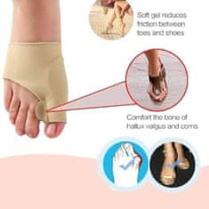 SOLFIT® Ortopedická pomôcka fixačná bandáž na vybočený palec na nohe (2 ks, ľavá + pravá strana) | FIXEDFEET